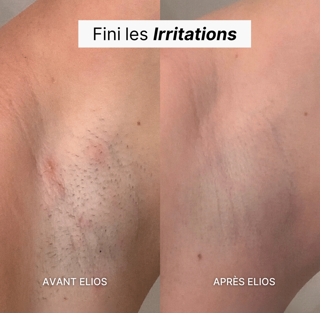 Elvéra™ | Rasoir Femme 5-en-1