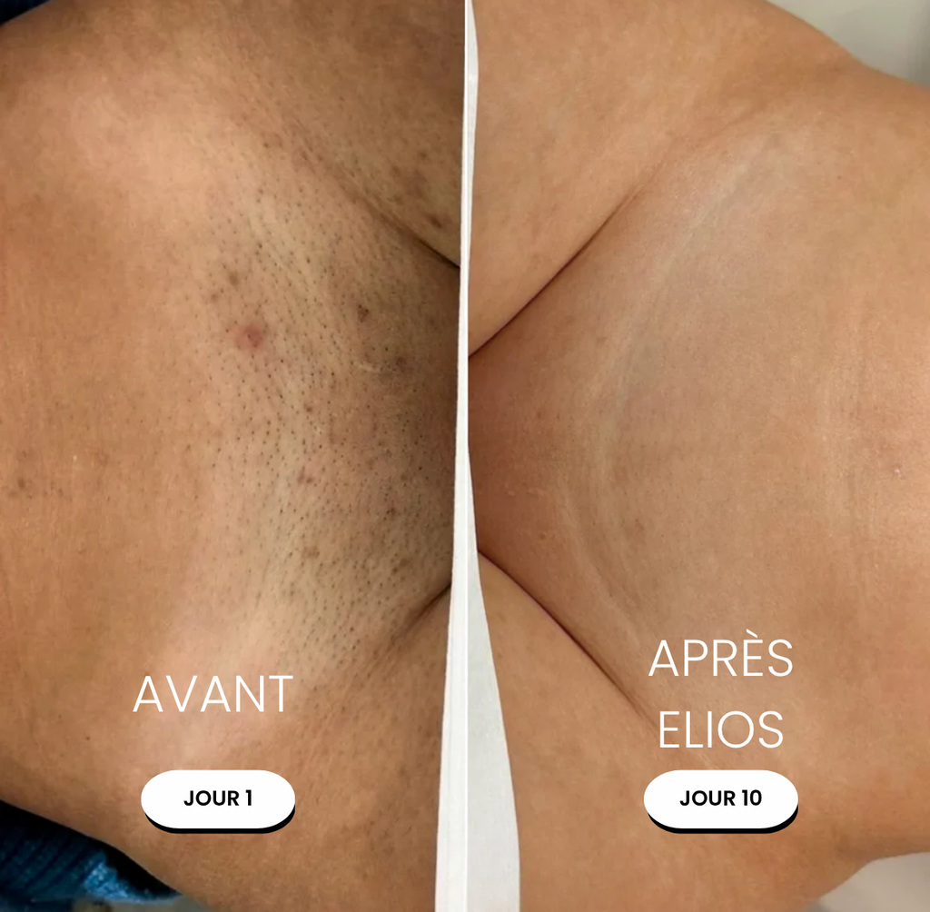 Elvéra™ | Rasoir Femme 5-en-1
