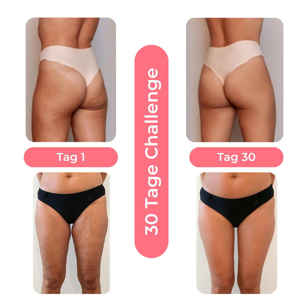 Steinsee Cellulite-Massage Pro