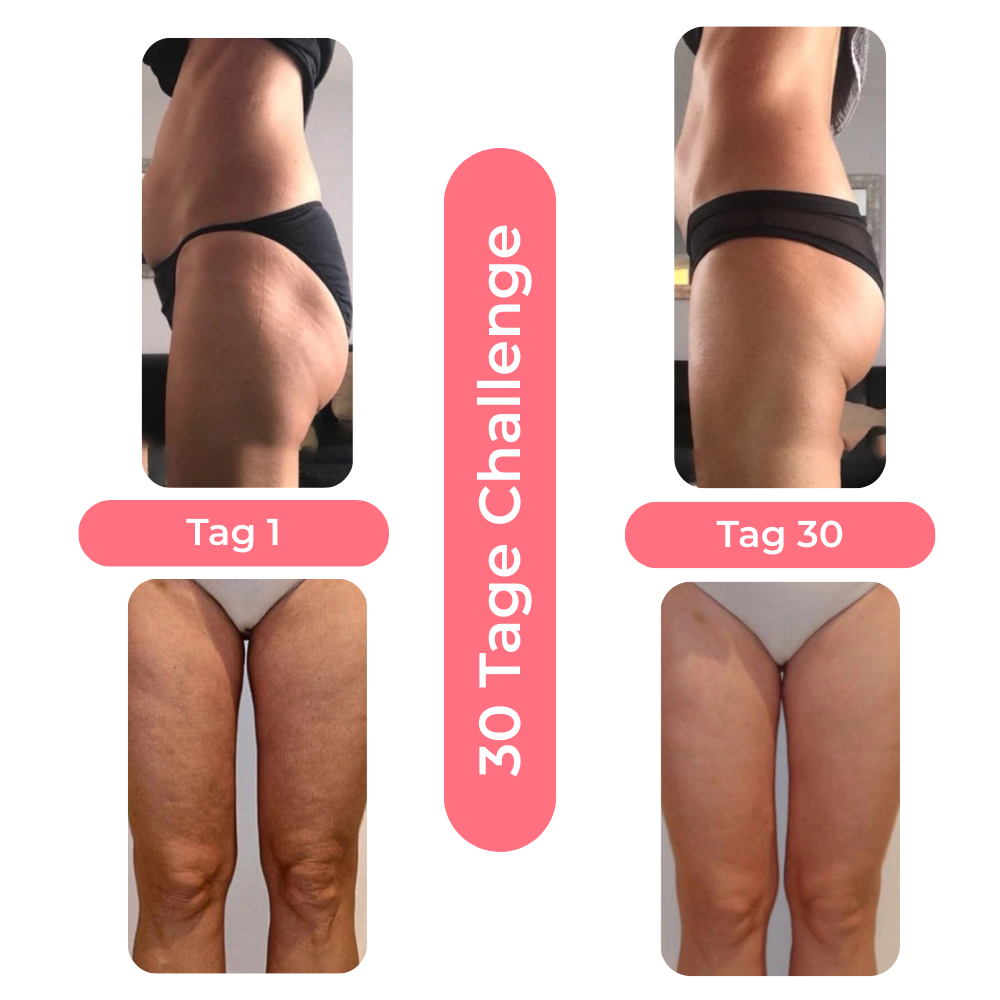 Steinsee Cellulite-Massage Pro